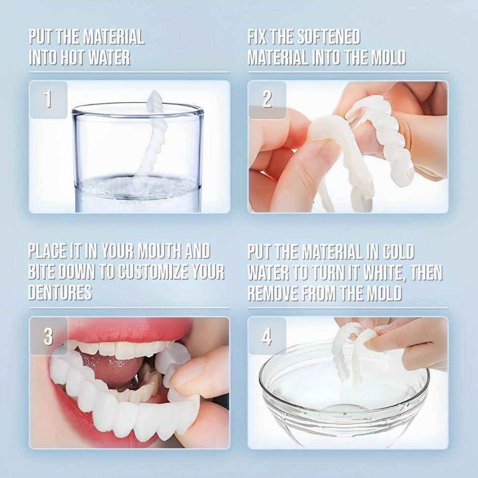 InstaSmile Shield™ (Top & Bottom Set Included)