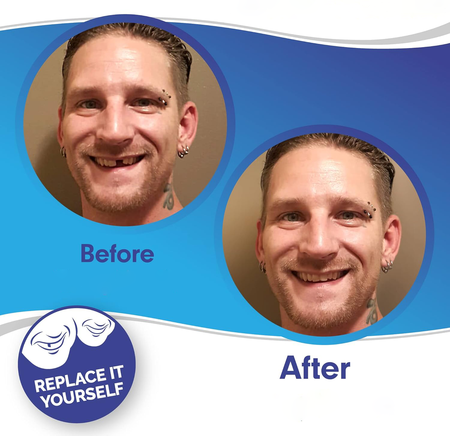 InstaSmile Shield™ (Top & Bottom Set Included)