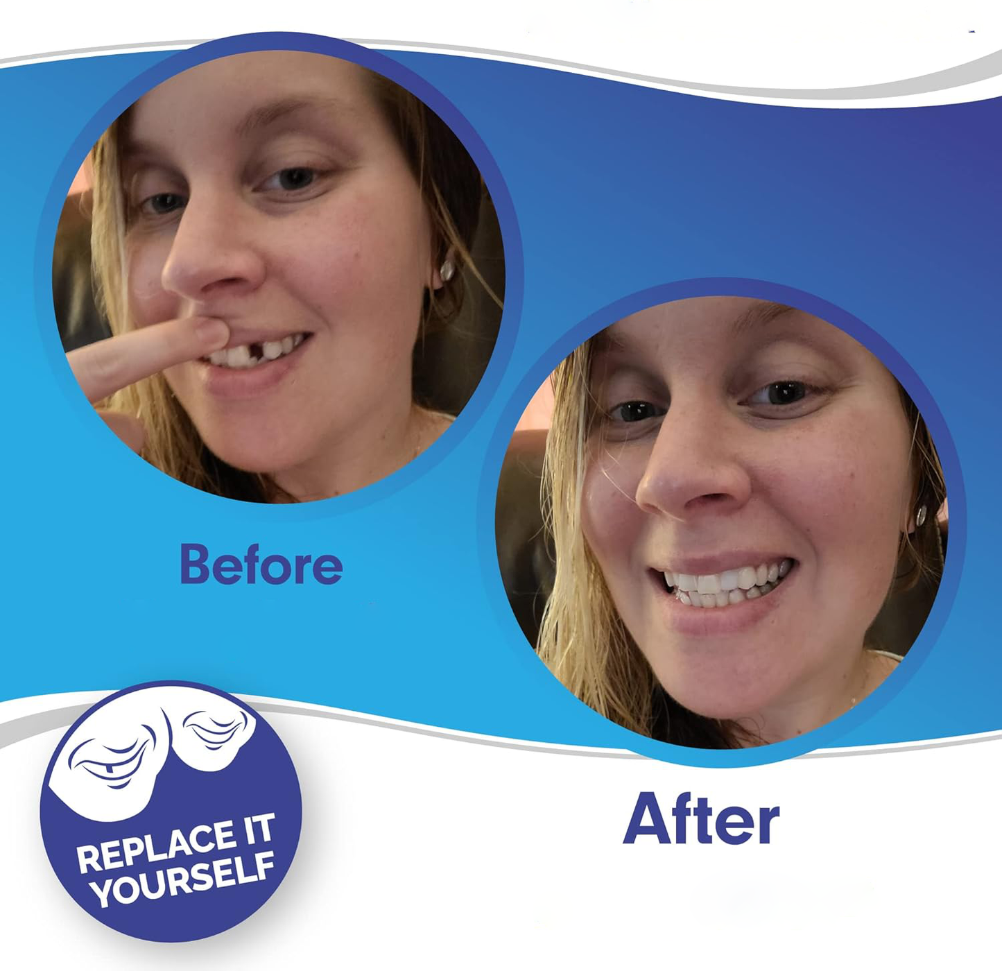 InstaSmile Shield™ (Top & Bottom Set Included)
