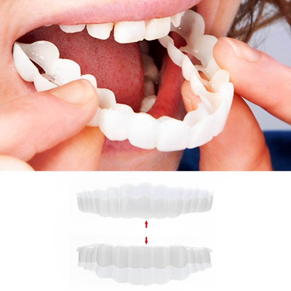 InstaSmile Shield™ (Top & Bottom Set Included)