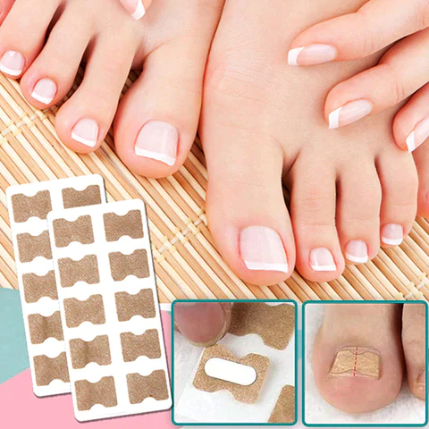 NailAlign™ | Corrective Patches for Beautiful and Healthy Nails