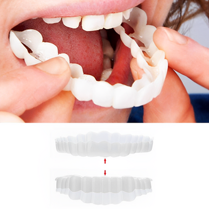 InstaSmile Shield™ (Top & Bottom Set Included)