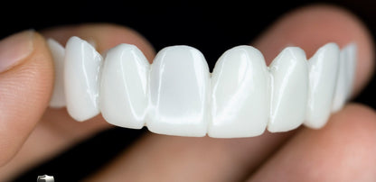 DentAlign Dental Prosthetics for Missing Teeth & Smile Restoration